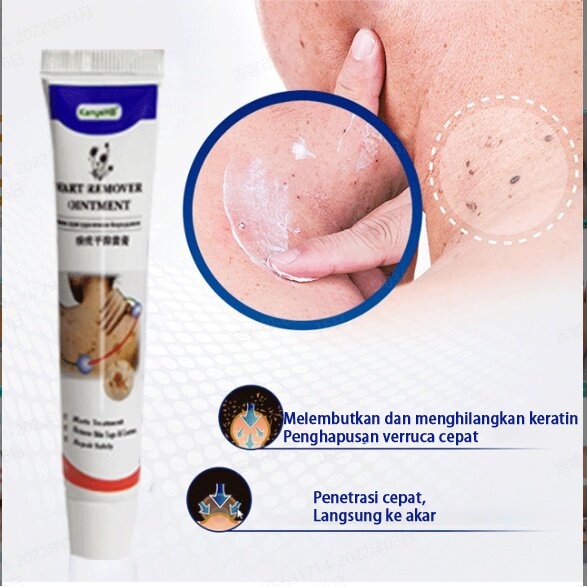 [100% ORI] Wart Remover Cream penghilang kutil Repair And Clean Skin Tag Remover 20g Obat Skin Tag di leher, Wajah, papiloma, kondiloma, kutil dan tahi lalat Menghilangkan Bpom Bahan botani alami, aman tanpa rasa sakit, tanpa efek samping