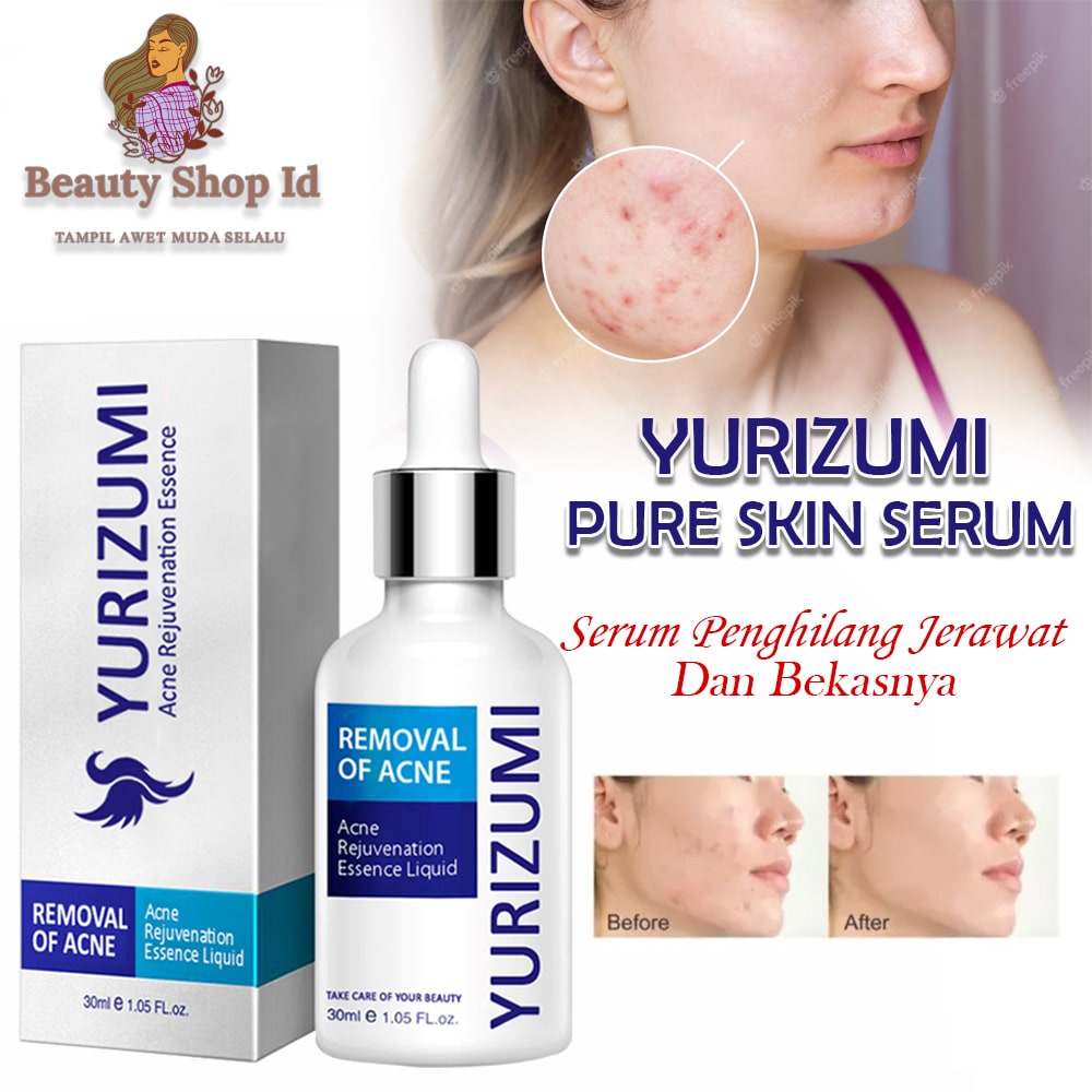 Beauty Jaya - Pure Skin Serum Acne Yurizumi Obat Jerawat Dan Bekas Jerawat