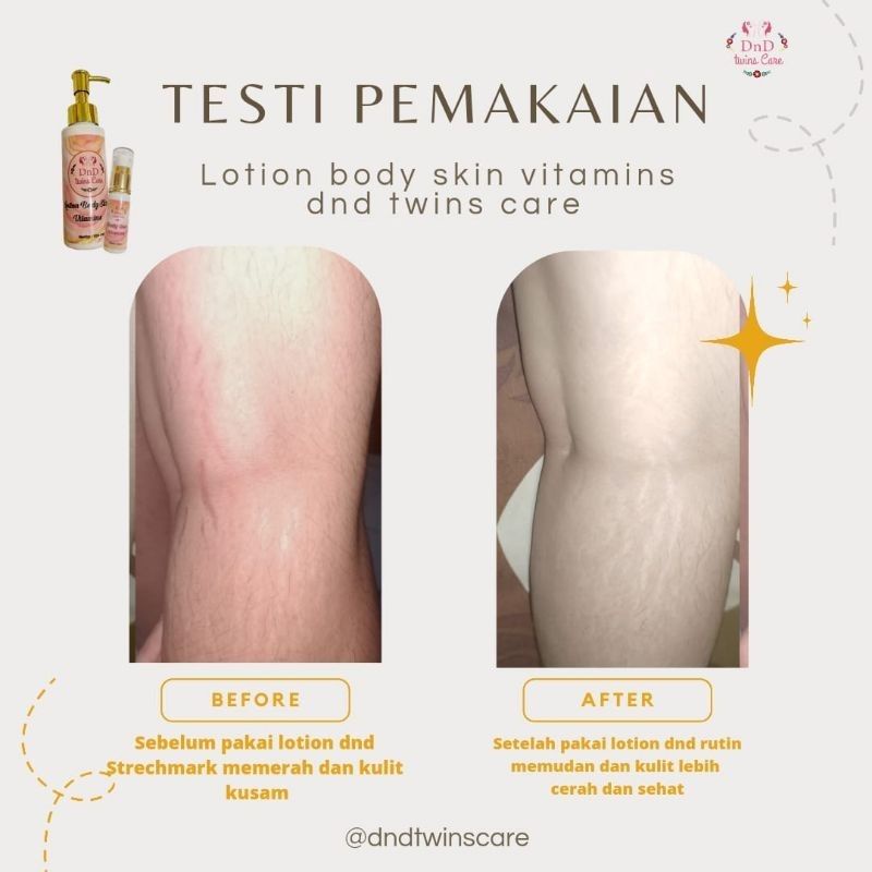 (READY STOK) Lotion vitamins body skin by Dnd Twins Care