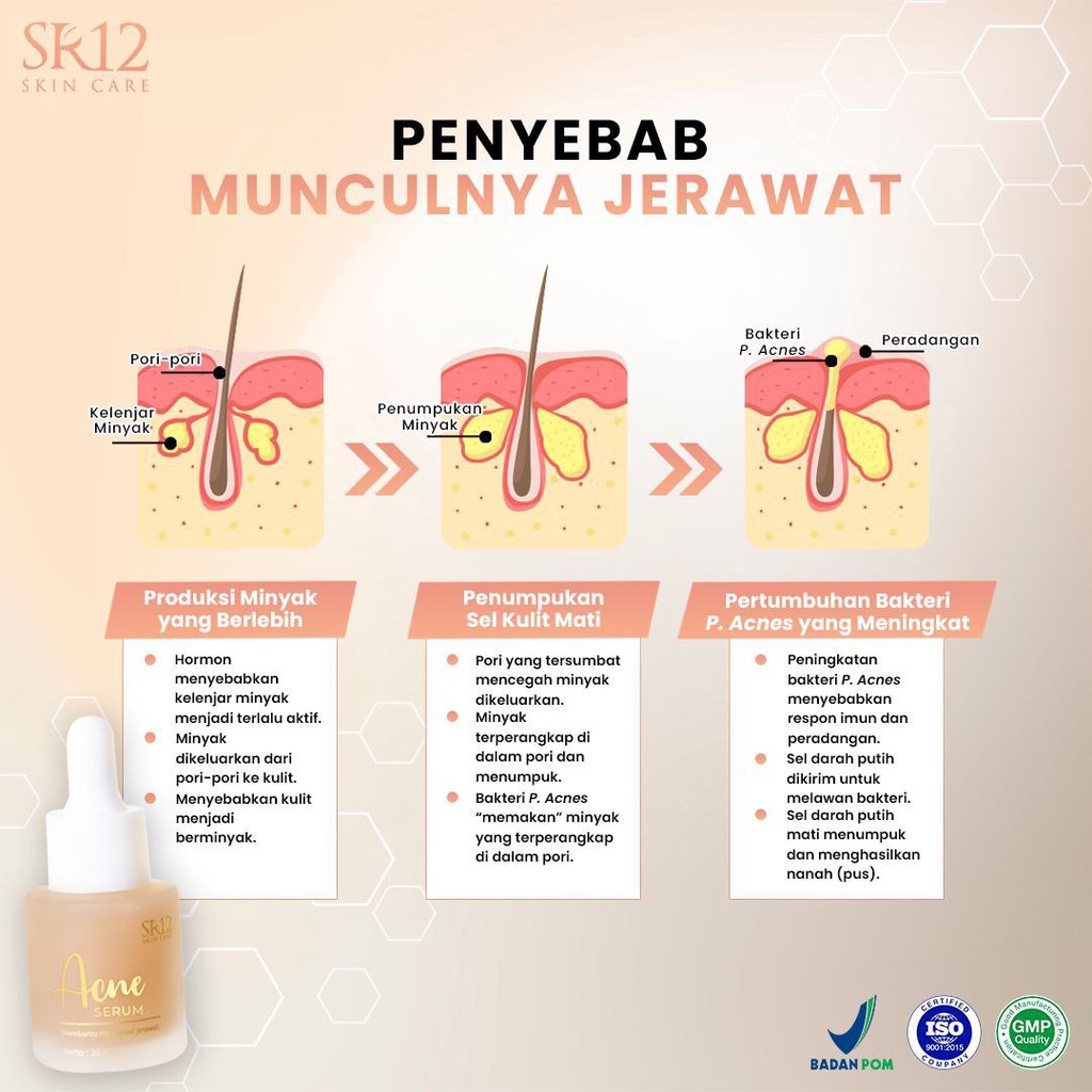 SERUM JERAWAT BPOM AMPUH..!! ACNE SERUM SR12 / OBAT PENGHILANG JERAWAT / SERUM RADANG JERAWAT