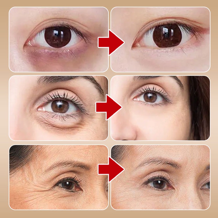 A-Alcohol Eye Essence Oil Meringankan garis halus kantung mata 1 pc
