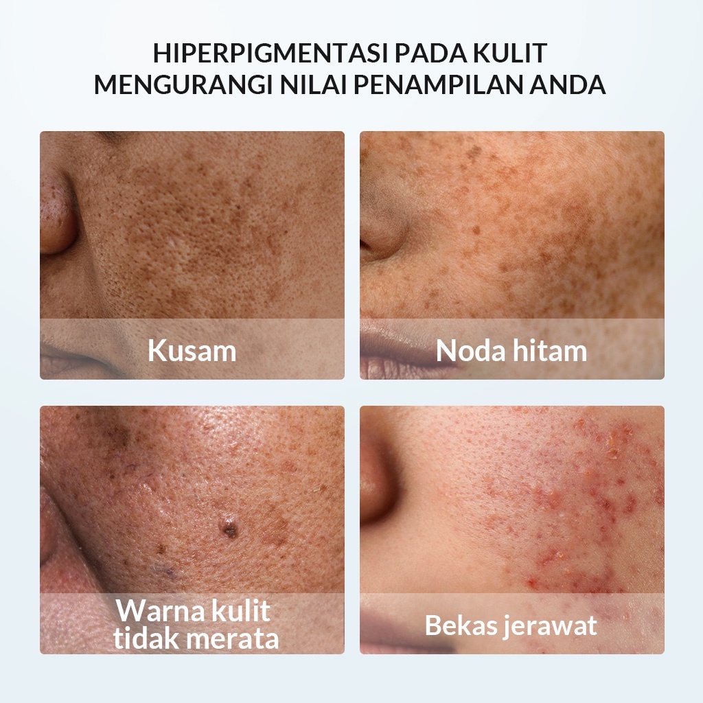 BIOAQUA Symwhite 377 Whitening &amp; Fade Dark Spot Serum 30mL