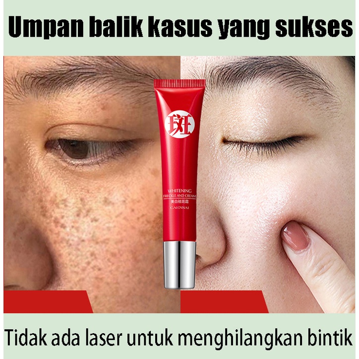 Dark Spot Serum Brightening Serum SPOT TREATMENT ACNE SPOT Krim PencerahMenghilangkan Melasma 20g Pemutih Efektif Penghilang Bintik hitam Diwajah