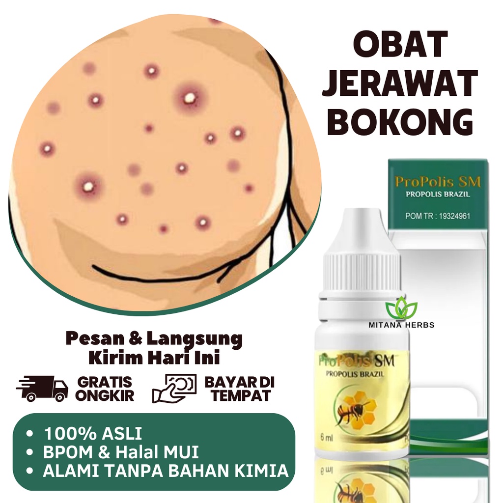Obat Jerawat Bokong - Obat Jerawat Pantat - Penghilang Jerawat Bokong - Penghilang Bruntusan Di Boko