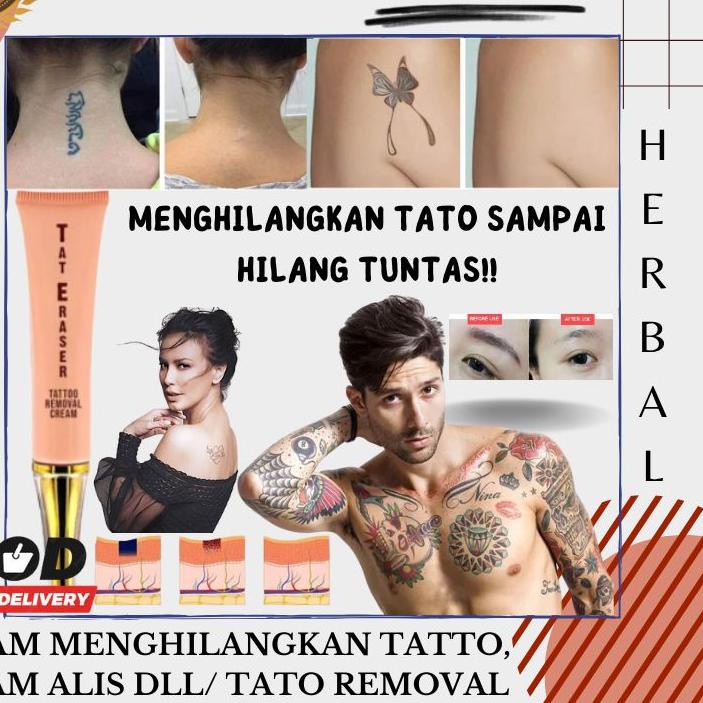 ☇ Krim Penghilang tatto tato removal ➭