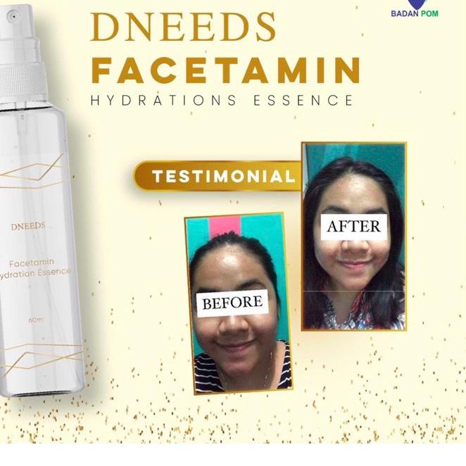 ➽ DNEEDS FACETAMIN ESSENSE ♣