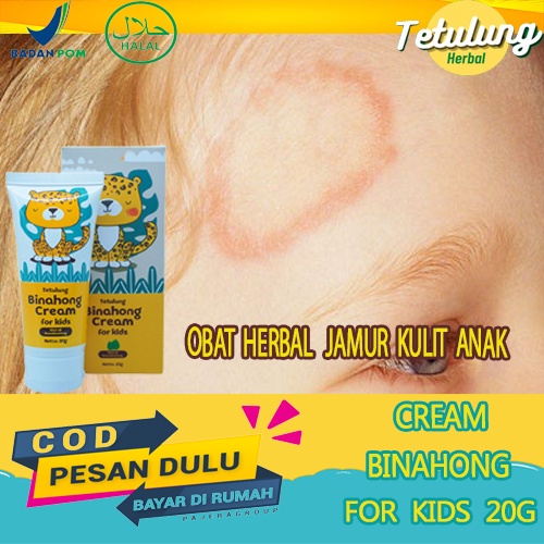 Obat Salep Gatal Kulit Alergi - Tetulung Binahong Cream For Kids Salep Jamur Kulit Untuk Bayi,Cream 