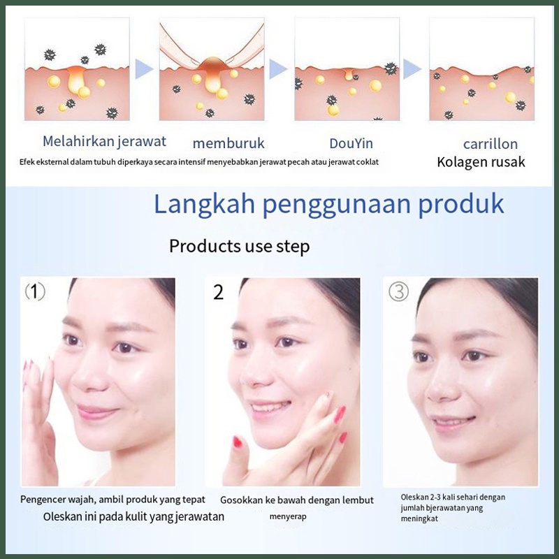 Penghilang jerawat Serum Gel jerawat Perawatan jerawat wajah Serum wajah acne 20G Menghilangkan jerawat, Bekas jerawat, Memudarkan bekas jerawat Esensi herbal Dengan lembut, aman dan cepat menghilangkan semua jenis jerawat dan bekas jerawat