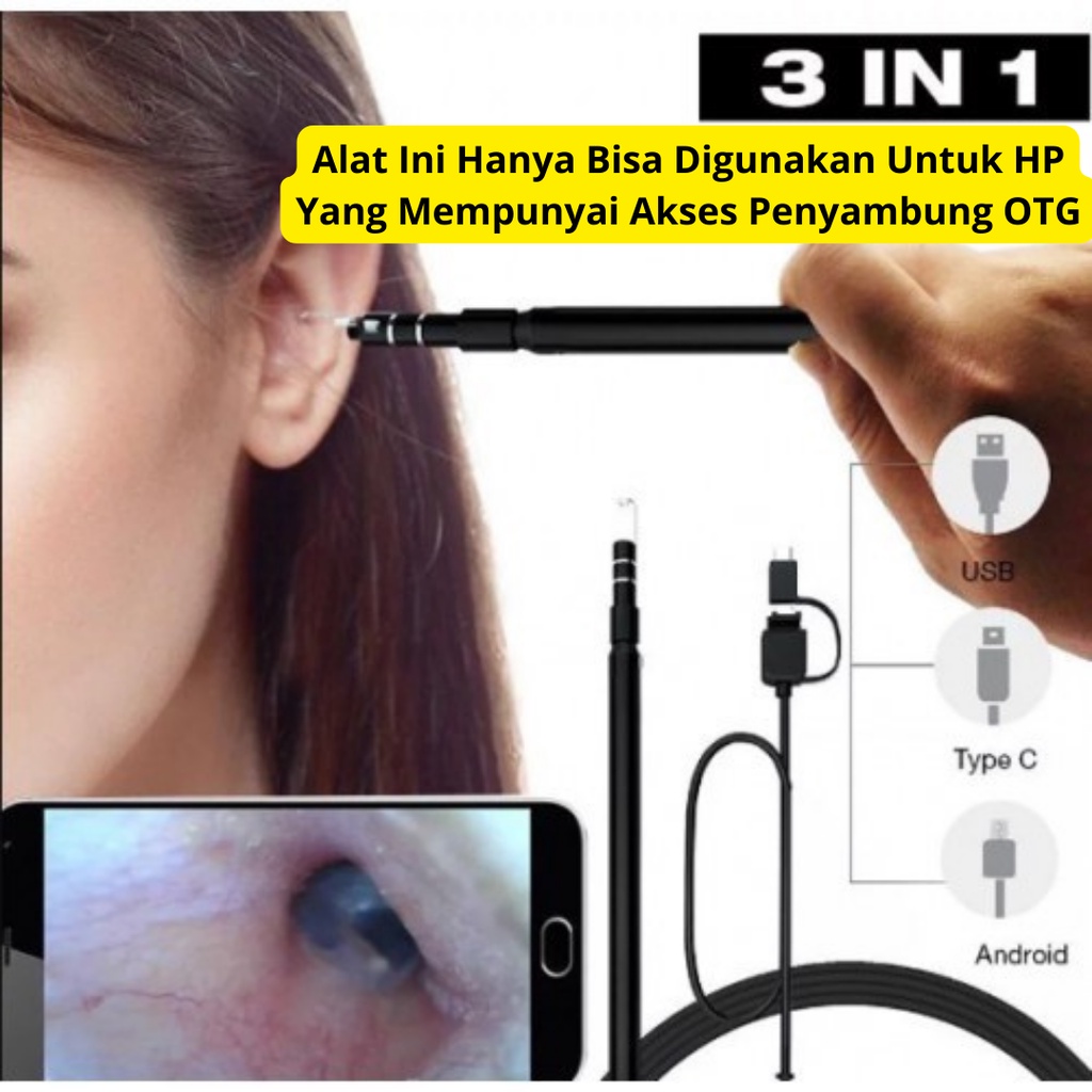 Alat Pembersih Telinga Anak Kamera 3in1 - Ear Cleaning Endoscope Telinga Mini Korek Kuping Kamera