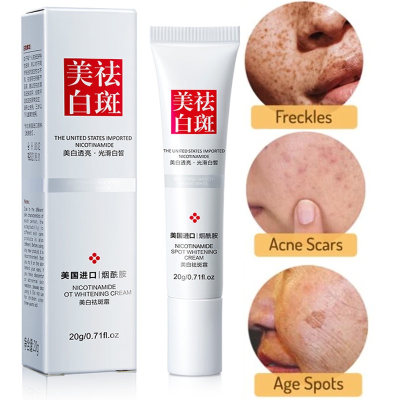 【COD】 Remove Dark Spots Anti Freckle Cream Niacinamide Fade Pigmentation Melasma Brighten Cream