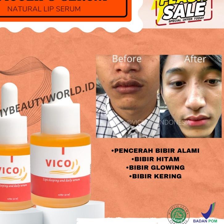 ✥ VICO LIPS SERUM BIBIR ORIGINAL | PENCERAH BIBIR | SERUM BIBIR | PEMERAH BIBIR | PEMERAH BIBIR PERM