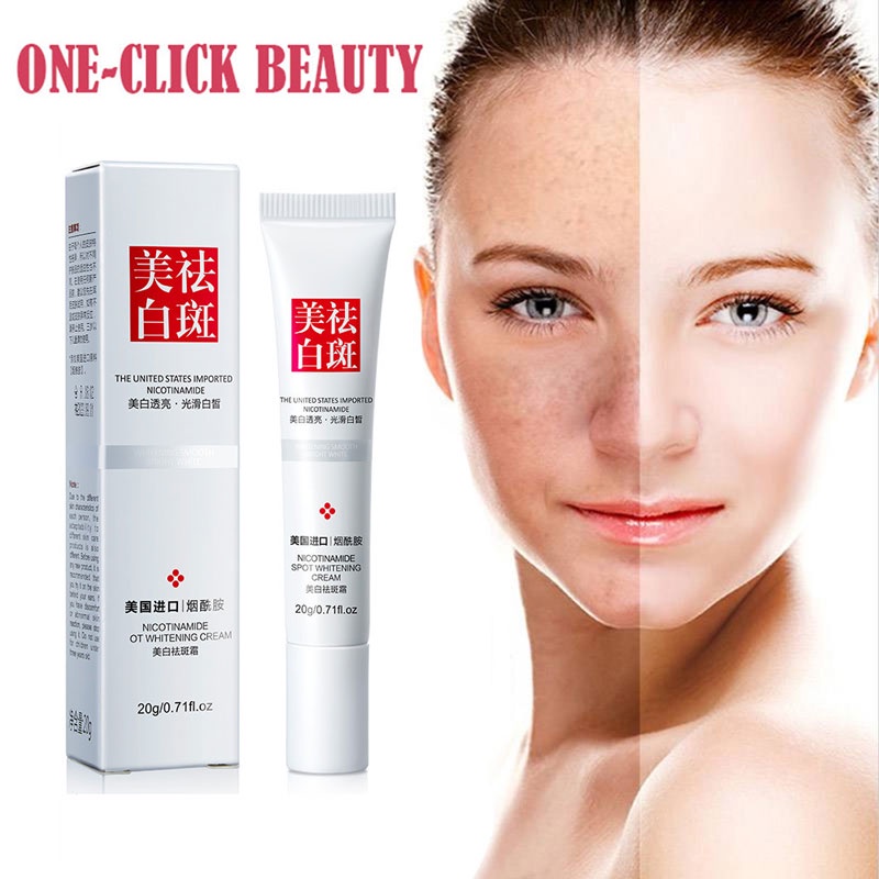 【COD】 Remove Dark Spots Anti Freckle Cream Niacinamide Fade Pigmentation Melasma Brighten Cream