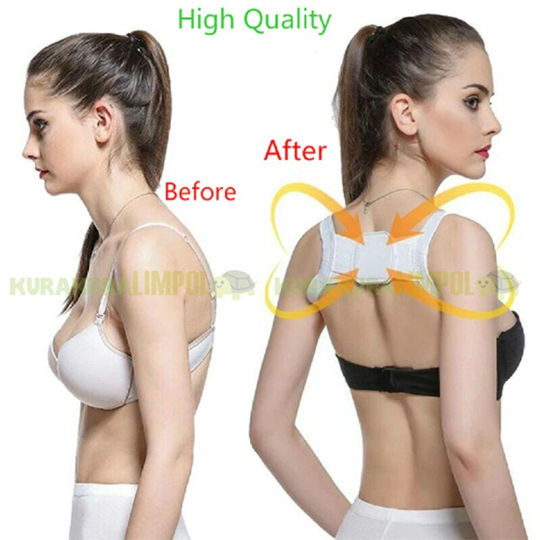 Penyangga Punggung Shoulder Back Support Belt Posture Corrector Korset Tali tulang Belakang alat penopang tubuh tegab berdiri terapi