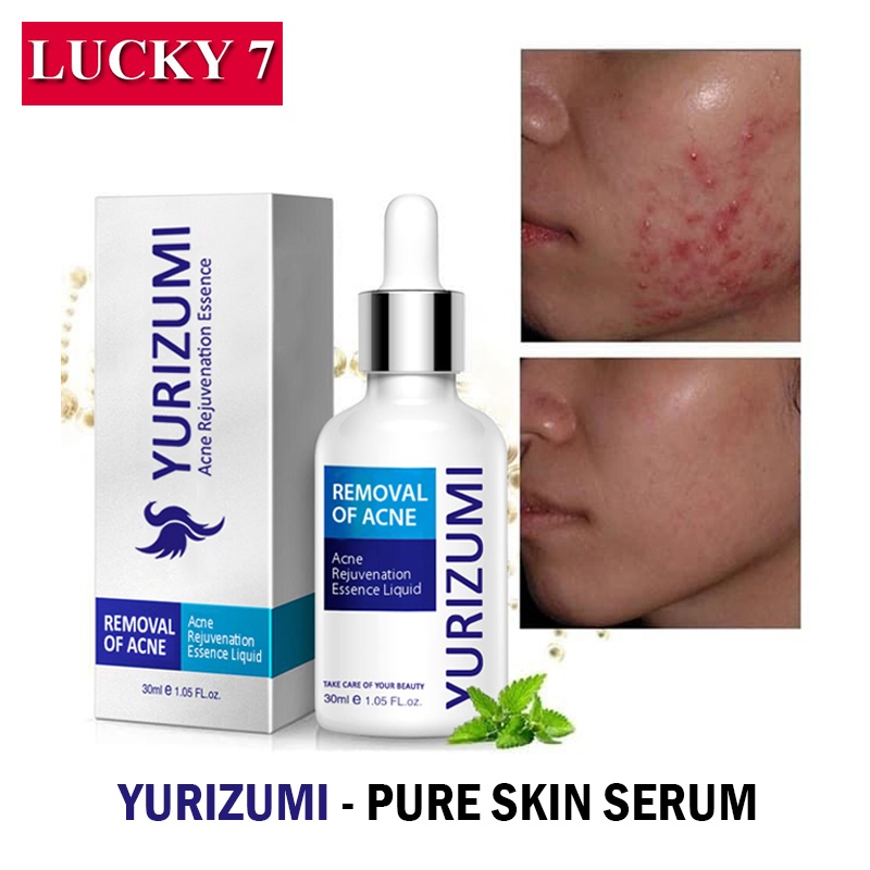 Serum Obat Jerawat paling Ampuh / Pure Skin Serum Menghilangkan Jerawat Maupun Bekas Jerawat