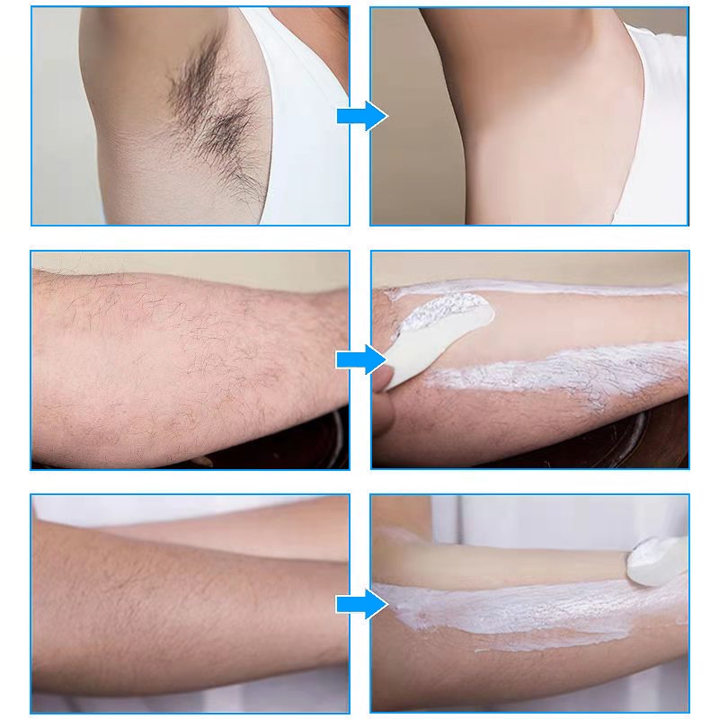 Penghilang Bulu ketiak Penghilang Bulu Baju  Hair Removal 120ml Hair Removal Spray Penghilang Bulu Kemaluan Wanita Ketiak, Dada, Kaki Dan Tangan Krim Penghilang Bulu Tidak Ada Flek Hitam