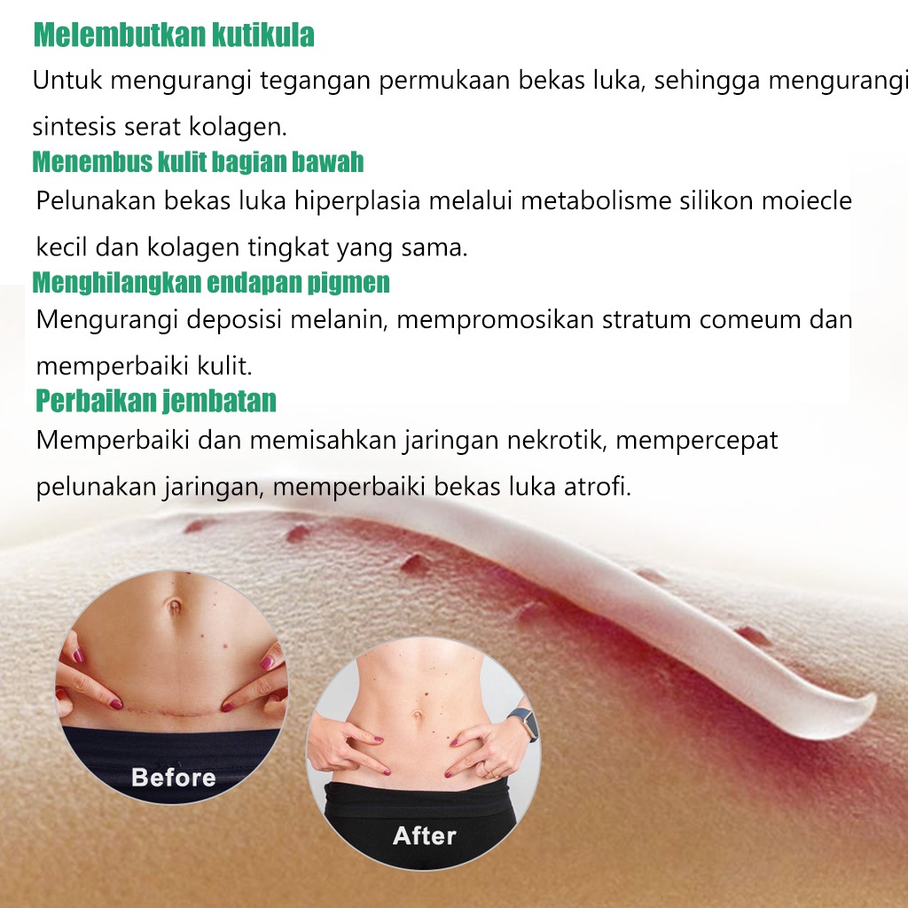 Menghilangkan bekas luka Krim salep bekas luka Gel bekas luka 20G Ampuh Ampuh Menghilangkan Bekas Luka Dapat Digunakan untuk Obat Pembakaran Bintik Hitam Kulit Bekas Luka Jahitan Bekas Luka Jerawat dan Stretch Mark