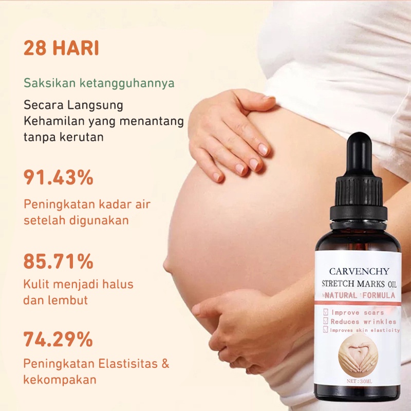 DADAWARD Stretch Mark Selulit Oil Penghilang Pemudar Stretch Mark/ Bio Oil / Penghilang Bekas Luka/ Strech Mark/ Penghilang Strech Mark/ Dry Skin Care