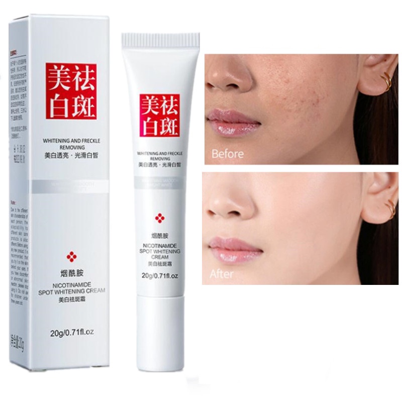 【COD】 Remove Dark Spots Anti Freckle Cream Niacinamide Fade Pigmentation Melasma Brighten Cream