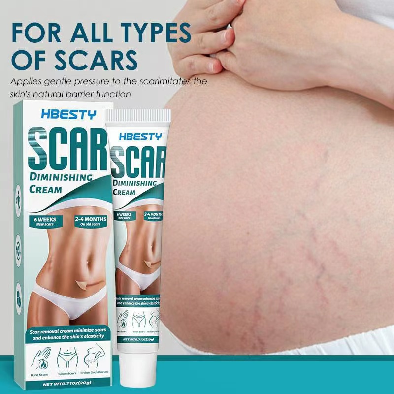 penghilang bekas luka  penghilang bekas jerawat menghilangkan bekas jerawat 20G salep penghilang bekas luka penghilang bekas luka hitam koreng  Bekas jerawat/salep luka bakar/salep luka/bekas luka caesar/stretch mark 100% asli