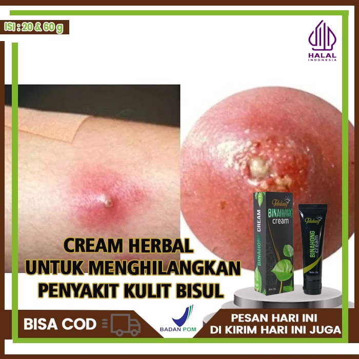 Obat Penghilang Bisul, Salep Bisul Paling Ampuh, Obat Bisul Bernanah, Cream Oles Bisul Paling Ampuh,