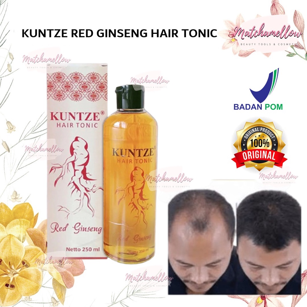 ❄️MATCHA❄️ KUNTZE RED GINSENG HAIR TONIC ORIGINAL BPOM / SOLUSI RAMBUT RONTOK