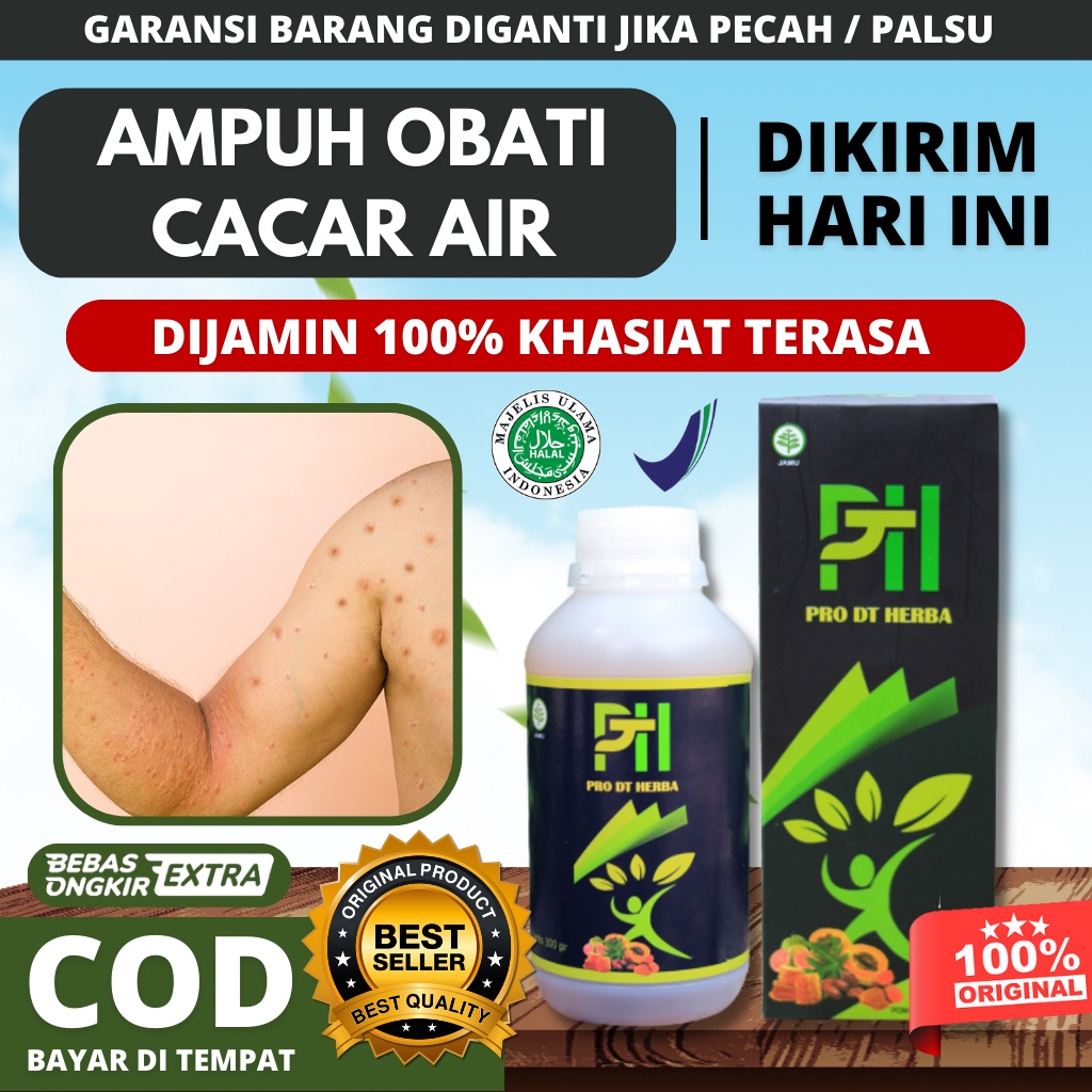 Obat Cacar Air Paling Ampuh, Penghilang Bekas Cacar, Obat Kulit Gatal Menahun, Alergi, Obat Cacar Ai