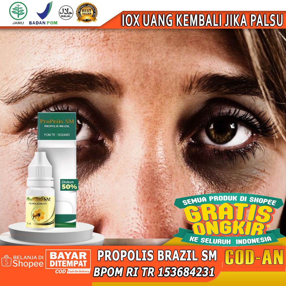 Obat Penghilang Warna hitam di kelopak mata, salep penghilang warna hitam di mata, milia di majah, P