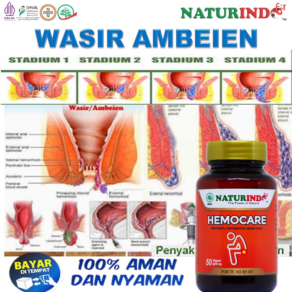 Obat Wasir Ambeien Wasir Berdarah Bengkak Ambeien Ambeyen Stadium 4