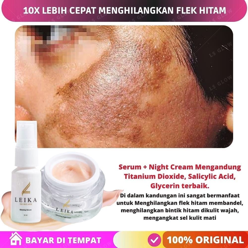 Paket Hemat Cream Penghilang Flek Hitam Membandel di Wajah / Obat Penghilang Flek Hitam yang Bagus d