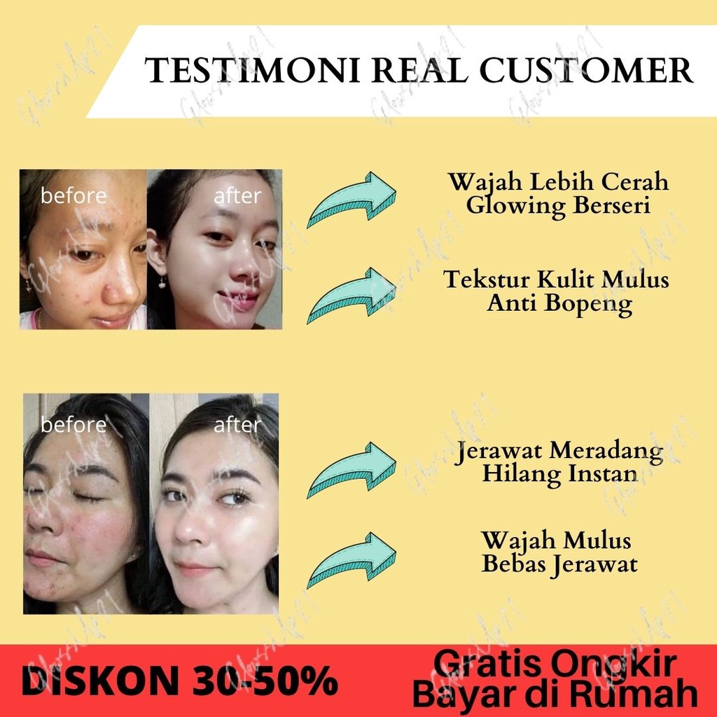 SABUN WAJAH PENGHILANG JERAWAT DAN BEKAS JERAWAT HANASUI ACNE TREATMENT GENTLE CLEANSER 60GR SABUN WAJAH HANASUI ACNE