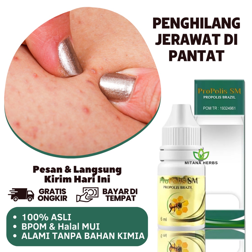 Penghilang Jerawat Pantat, Obat Jerawat Pantat, Obat Jerawat Bokong, Obat Bruntusan Di Pantat, Obat 