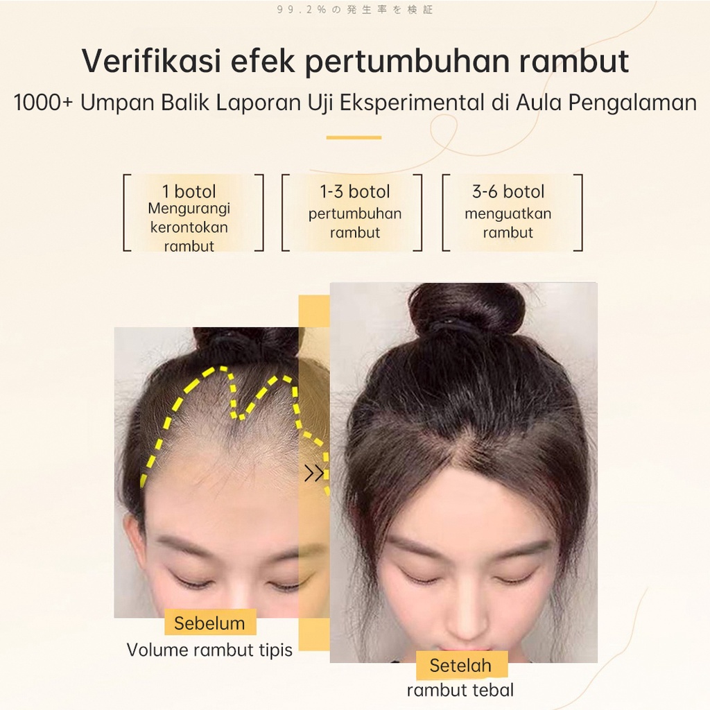 Essence Pertumbuhan Rambut Cepat, Anti-rambut Rontok Pengkondisian Anti-Rambut Rontok, Mendorong Regenerasi Rambut, Mencegah Rambut Rontok, Memelihara Perbaikan Kulit Kepala, Garis Rambut Tebal, Kondisioner Pria dan Wanita