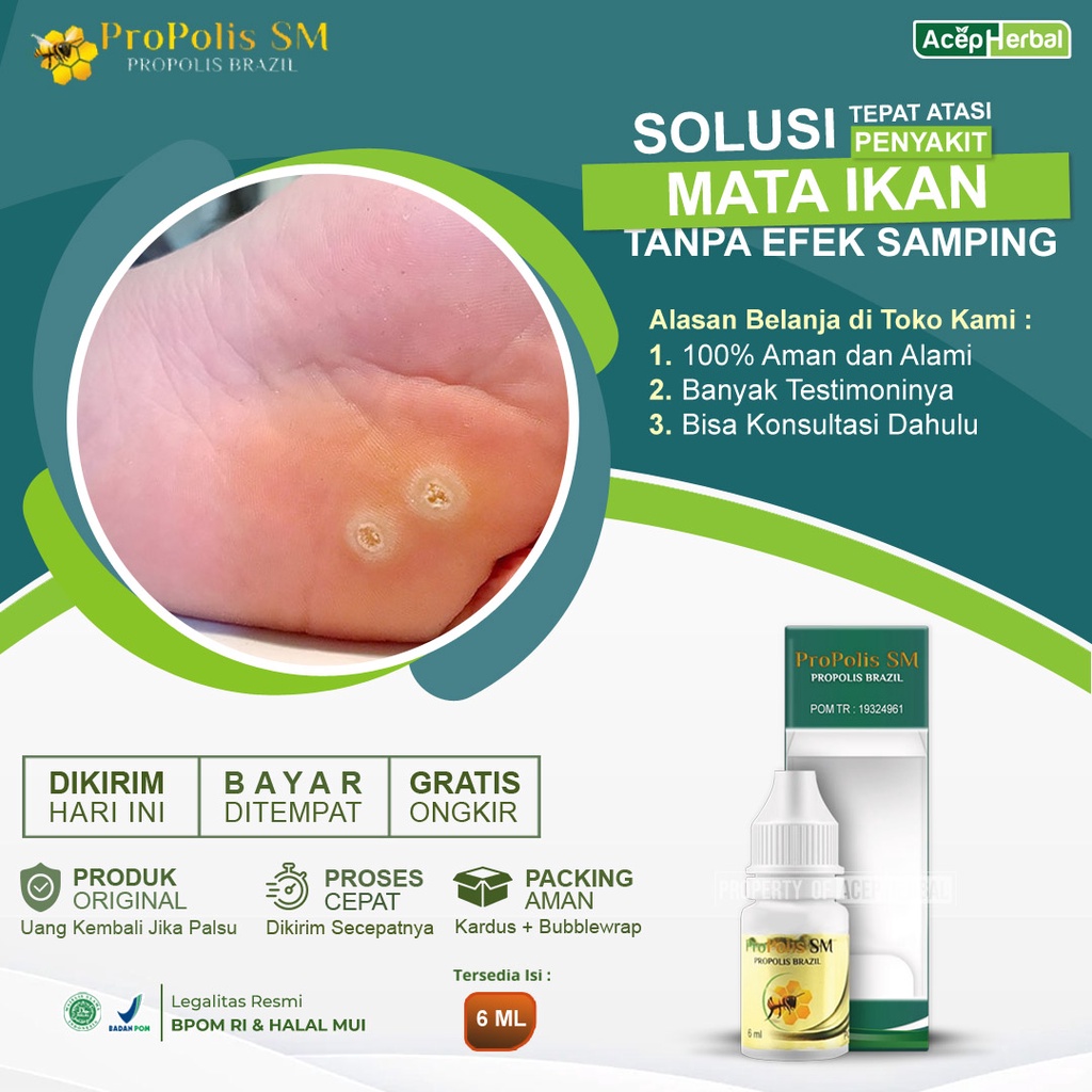 Obat Tetes Mata Ikan Kronis Akut Anak Dan Dewasa Pengering Luka Tetanus - Propolis SM Brazil Origina