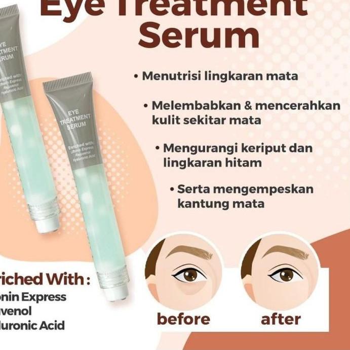 ✧ EYE CREAM MS GLOW ORI EYE DARK CIRCLE CREAM - CREAM MATA eye treatment ms glow ➺