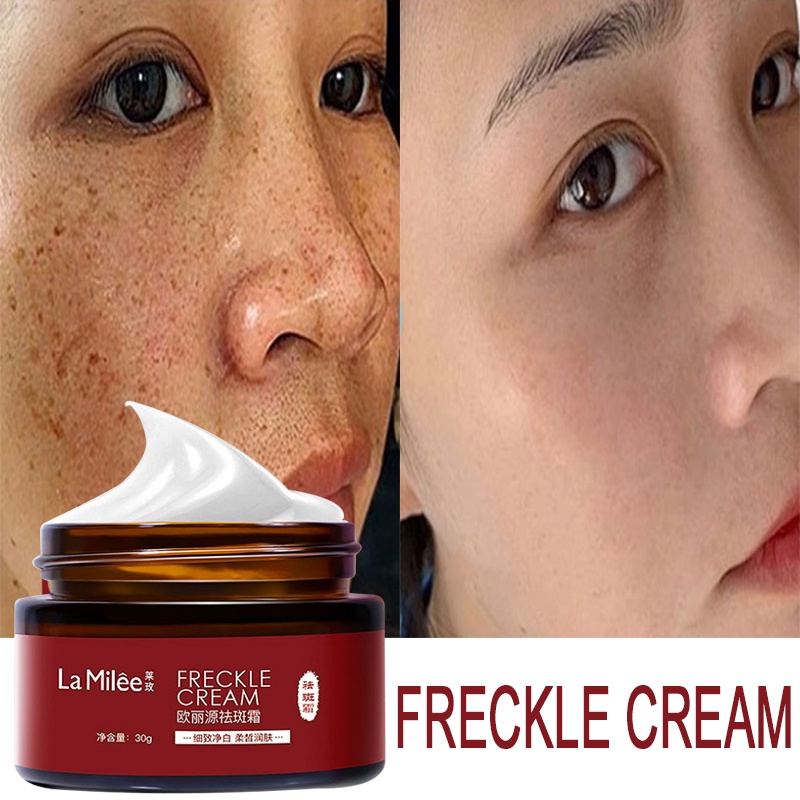 Krim penghilang flek penghilang flek hitam salep flek hitam melasma 30g krim penghilang pigmentasi dan penghilang bintik hitam, krim pemutih wajah, pemutih