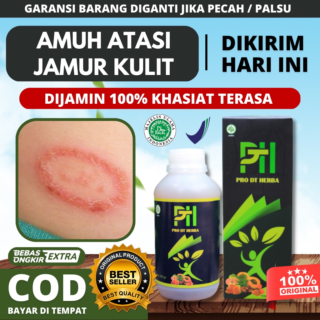 Obat Jamur Kulit Paling Ampuh, Jamur Kulit Kepala Panu Kadas Kurap Gatal Selangkangan Gatal Seluruh 