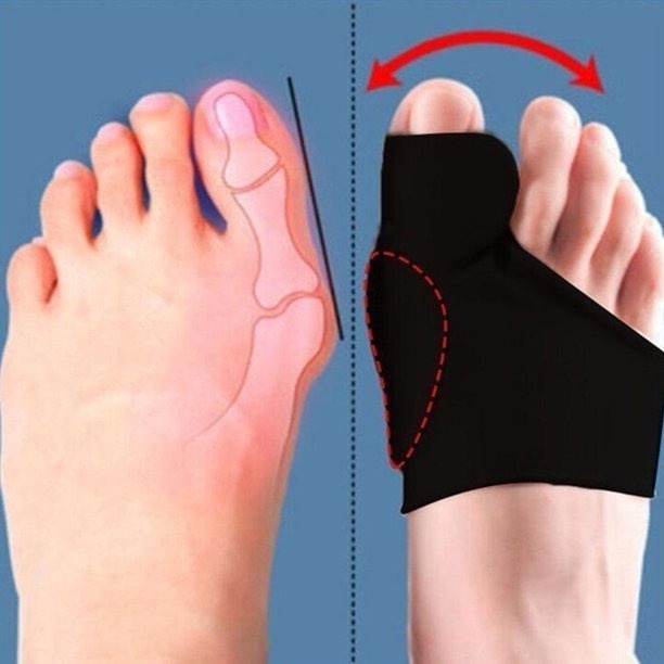 GV8 Geonyi Pelurus Jempol Kaki Hallux Valgus Bunion Corrector Sleeve 2pcs Size S Ge1408 Black Or-i