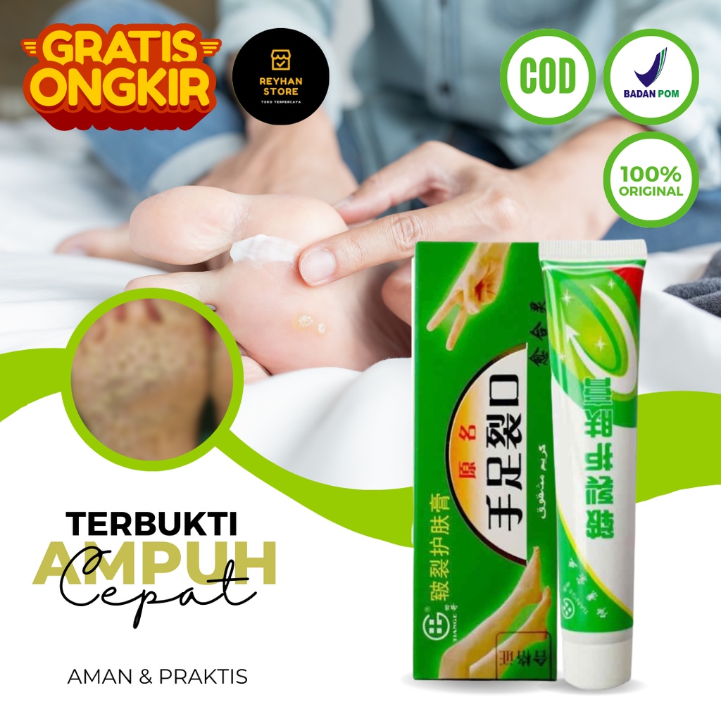 RB Obat Kaki Rayapan Dan Bau Salep Cina Obat Gatal Krim Pengelupas Kulit Mati Kaki Pembersih Kulit