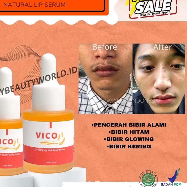♧ VICO LIPS SERUM BIBIR ORIGINAL | PENCERAH BIBIR | SERUM BIBIR | PEMERAH BIBIR | PEMERAH BIBIR PERM