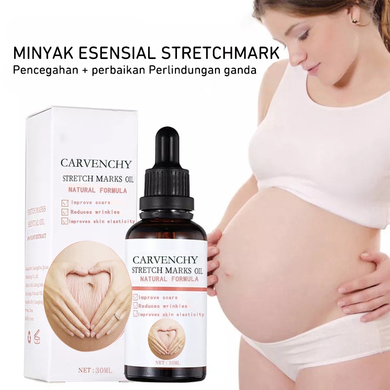 Stretch Mark Selulit Oil Penghilang Pemudar Stretch Mark/ Bio Oil / Penghilang Bekas Luka/ Strech Mark/ Penghilang Strech Mark/ Dry Skin Care