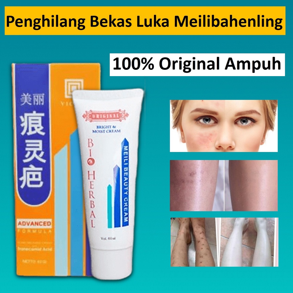 Krim Penghilang Bekas Luka Meilibahenling Meili Beauty Cream Original 100% Asli