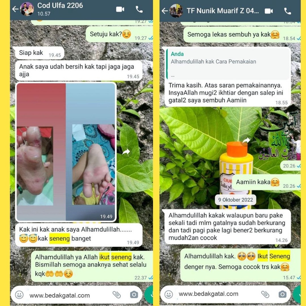 BELI 1 GRATIS 1 BEDAK GATAL SALICYL - BEDAK GATAL BPOM BANTU HILANGKAN GATAL JAMUR KUTU AIR PANU KURAP ALERGI KULIT