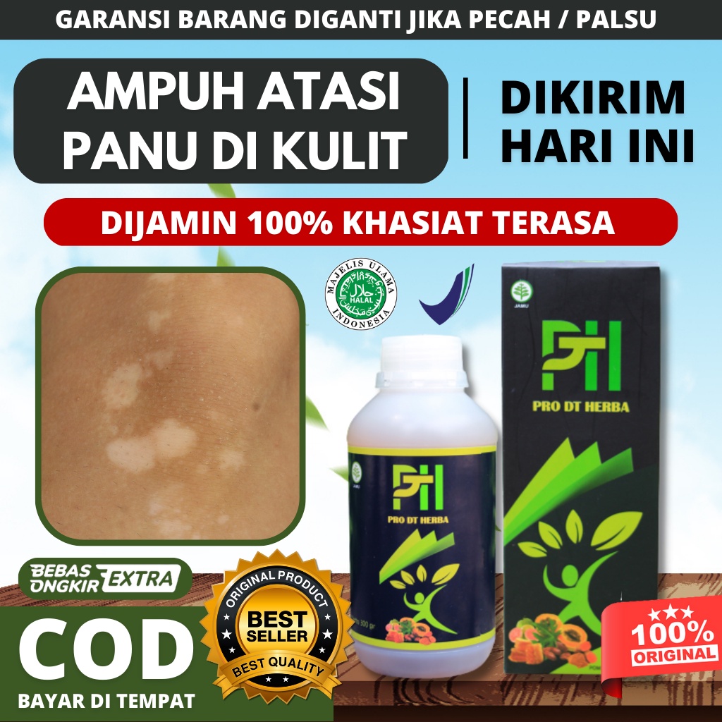 Obat Panu Paling Ampuh 100% Dan Paling Cepat - Obat Panu Anak - Obat Panu Dewasa - Obat Bekas Panu -