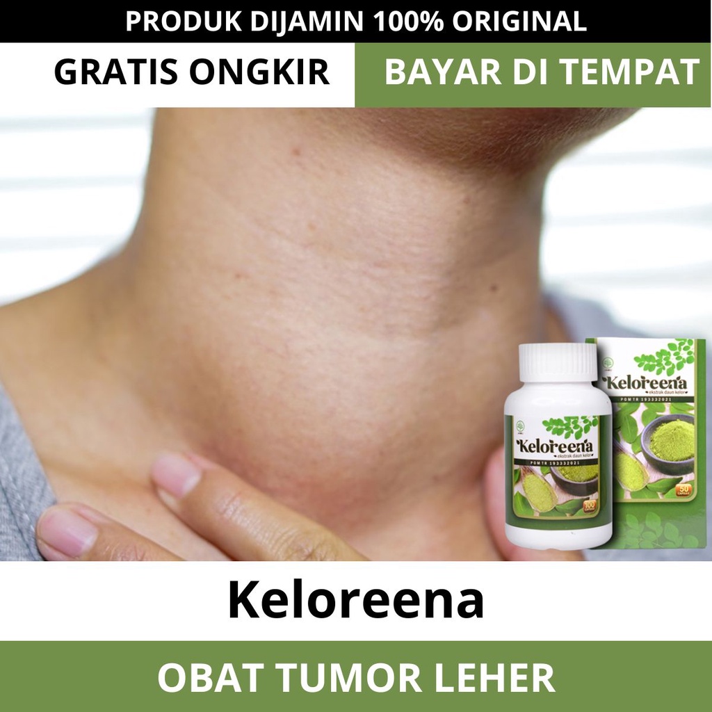 Obat Tumor Di Leher - Penghancur Sel Tumor Ganas Dan Jinak Pada Leher, Penghilang Penyakit Tumor Col