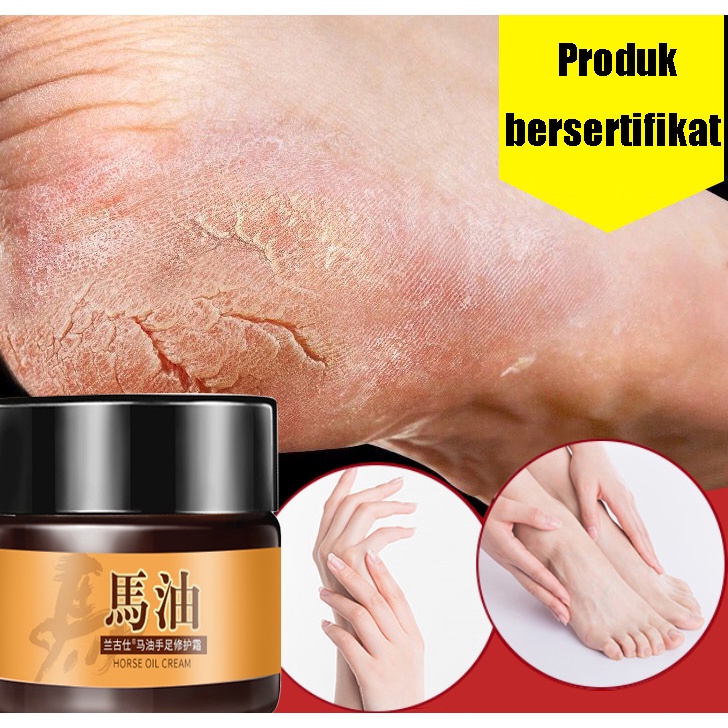 Obat Kaki Pecah Krim tangan dan kaki Kering Foot Cream Krim Herbal China 30g Kaki Kapalan Pecah Kering Cream Kaki Pecah Obat Tumit Pecah Tangan Kapalan Pecah Kasar Kering