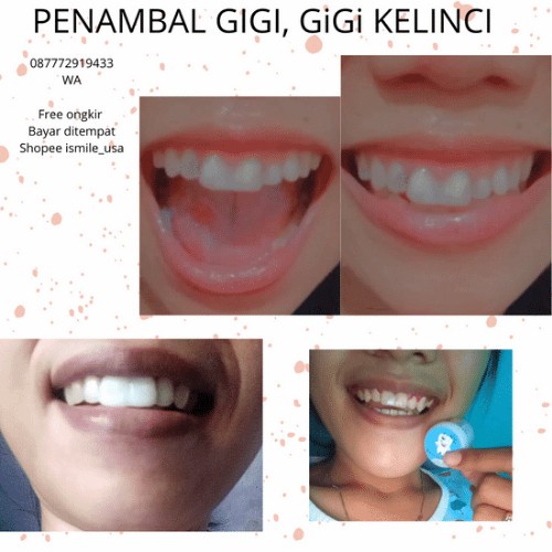 TERLARIS- GIGI PALSU / GIGI KELINCI / GIGI KPOP (NEW)