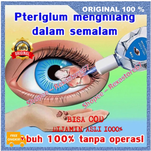 Obat Tetes Mata Pterigium  Menghilang Dalam Semalam Glaukoma , Katarak , Rabun Jauh Ampuh ASLI