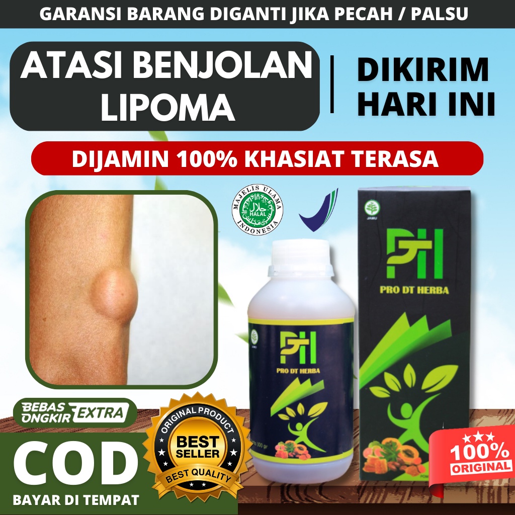 Obat Lipoma Benjolan Oles - Obat Lipoma Ampuh Terbukti - Obat Lipoma Benjolan Original - Obat Lipoma
