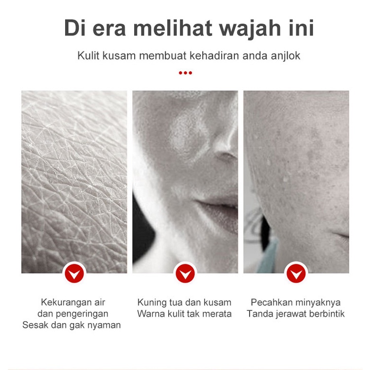 Dark Spot Serum Brightening Serum SPOT TREATMENT ACNE SPOT Krim PencerahMenghilangkan Melasma 20g Pemutih Efektif Penghilang Bintik hitam Diwajah