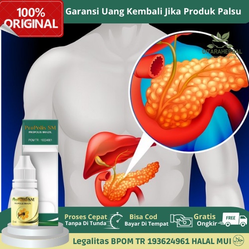 Obat pankreatitis, Obat Radang Pankreas, Obat Pankreatitis Akut, Obat Pankreatitis Kronis, Obat Nyer